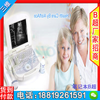 深圳三维祥生b超厂家 正品医用b超机深圳三维
