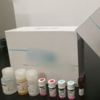 人单核细胞趋化蛋白-1(MCP-1)检测试剂盒（ELISA