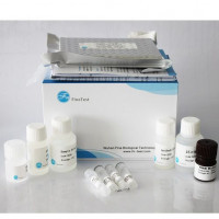 Rat Agt ELISA Kit|大鼠血管紧张素原(AGT