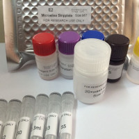 小鼠β淀粉样蛋白1-42(Aβ1-42)ELISA试剂盒