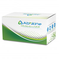 EliKine™ 大鼠糖化血红蛋白A1c(GHbA1C) E