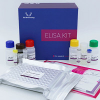 Human IL6(Interleukin 6) ELISA