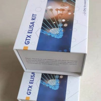 小鼠甘油三酯(TG)Elisa试剂盒
