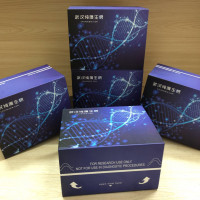 裸鼠晚期糖基化终末产物(AGEs)ELISA试剂盒