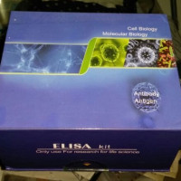 人可溶性晚期糖基化终末产物受体（sRAGE）Elisa