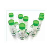 弓蛔虫IgG试剂盒,Toxocara canis IgG E