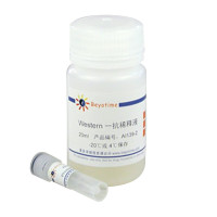 Phospho-CDC37 (Ser13) Rabbit M