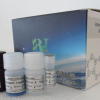 兔子白介素8(IL-8/CXCL8)ELISA试剂盒厂家
