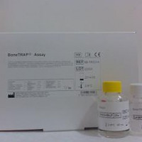 供应抗酒石酸酸性磷酸酶5b ELISA试剂盒 TRACP 5