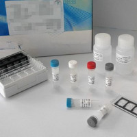 人抗人类免疫缺陷病毒抗体(HIV)ELISA试剂盒