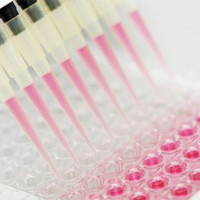 Rat AZU/HBP(Azurocidin/Heparin