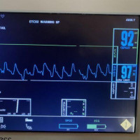 Used - Good INVIVO 9311