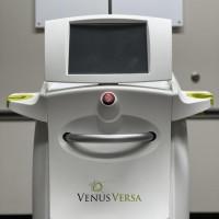 Used VENUS Versa