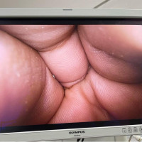 Used - Good OLYMPUS WA50040A