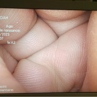 Used - Good OLYMPUS WA50010A