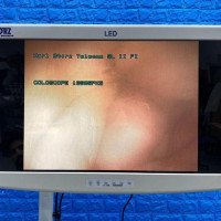 Used - Good KARL STORZ 13905PKS