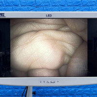 Used - Good KARL STORZ 13821PKS