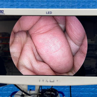 Used - Good KARL STORZ Image 1 H3 HD