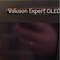 Used - Like New GE Voluson E10