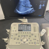 New ESAOTE MyLab X6