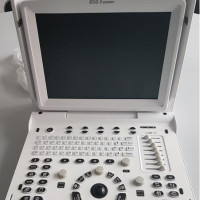 Demo CHISON ECO 3 EXPERT