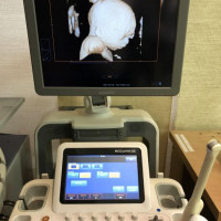 Refurbished SAMSUNG Accuvix XG