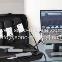 New CHISON SonoAir 70