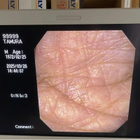 Used - Good OLYMPUS OEV262H