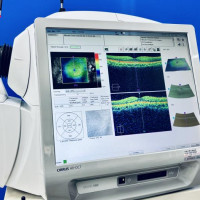 Pre-Owned - Excellent ZEISS CIRRUS HD-OCT 500