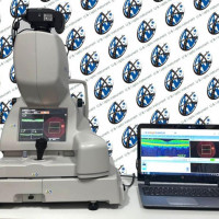 Refurbished TOPCON 3D OCT-2000