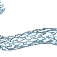 BOSTON SCIENTIFIC SYNERGY Everolimus-Eluting Platinum Chromium Coronary Stent System Stent
