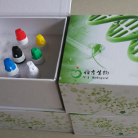人皮肤T细胞虏获趋化因子(CTACK/CCL27)化学发光试