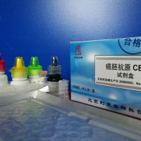 癌胚抗原（CEA）检测试剂盒