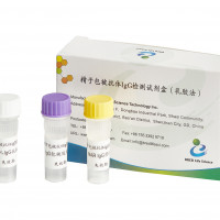 精子包被抗体IgG检测试剂盒(MAR-IgG)