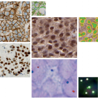 VISIOPHARM定量数字病理图像分析软件TISSUEmo
