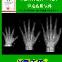 中国人骨发育（骨龄）评定应用软件（骨龄软件）——临床专家版