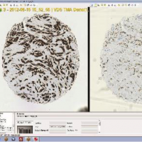 VISIOPHARM定量数字病理图像分析软件TMAworkf