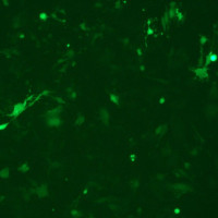 人胸膜双相间皮瘤细胞NCIH2452/GFP (带绿色荧光)