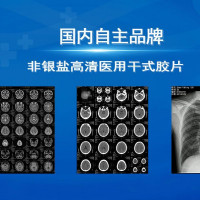 国产专业医用胶片品牌知名