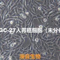 HGC-27[HGC 27; HGC27]人胃癌细胞（未分化