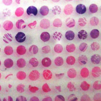 乳腺组织芯片BRC1501