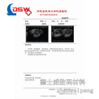 20丝白基医用彩色CT胶片A3
