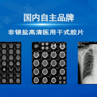 国产医用胶片厂家