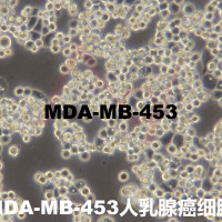 MDA-MB-453[MDA-MB 453; MDA MB
