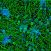 Axol Bioscience axoCells感受神经元