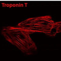 iPSCs derived cardiomyocytes