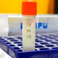 冻存PBMC（人外周血单个核细胞）hPBMC 单个核细胞