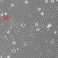 NCI-H647人肺小癌细胞、NCI-H647细胞（附STR