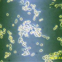 小鼠乳腺癌细胞，CCC-Ca761-03