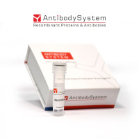 Recombinant Human OSBPL2 Prote